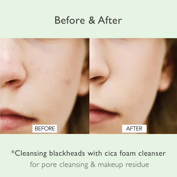 Cica Pore Cleansing Foam